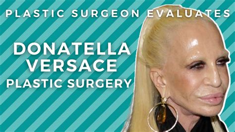 amazon versace per donna|donna versace before surgery.